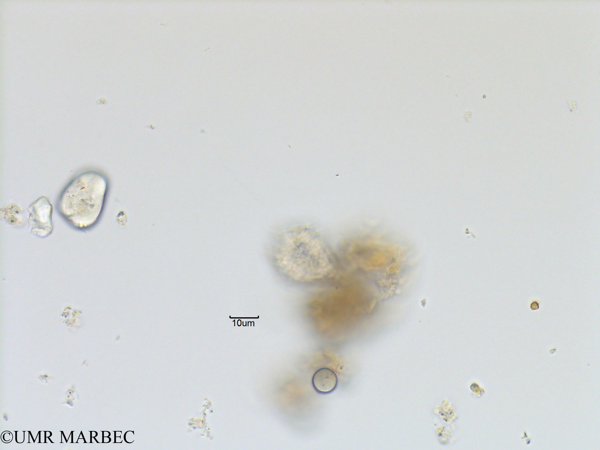 phyto/Bizerte/bizerte_lagoon/RISCO November 2015/Scrippsiella spinifera (Protoperidinium sp15-Lagune_T1_B_Dino b-3).tif(copy).jpg